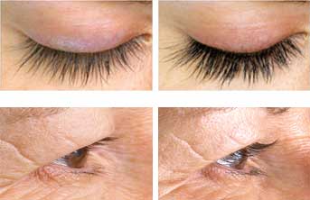eyelash-serum-before-after eyelash-serum-before-after